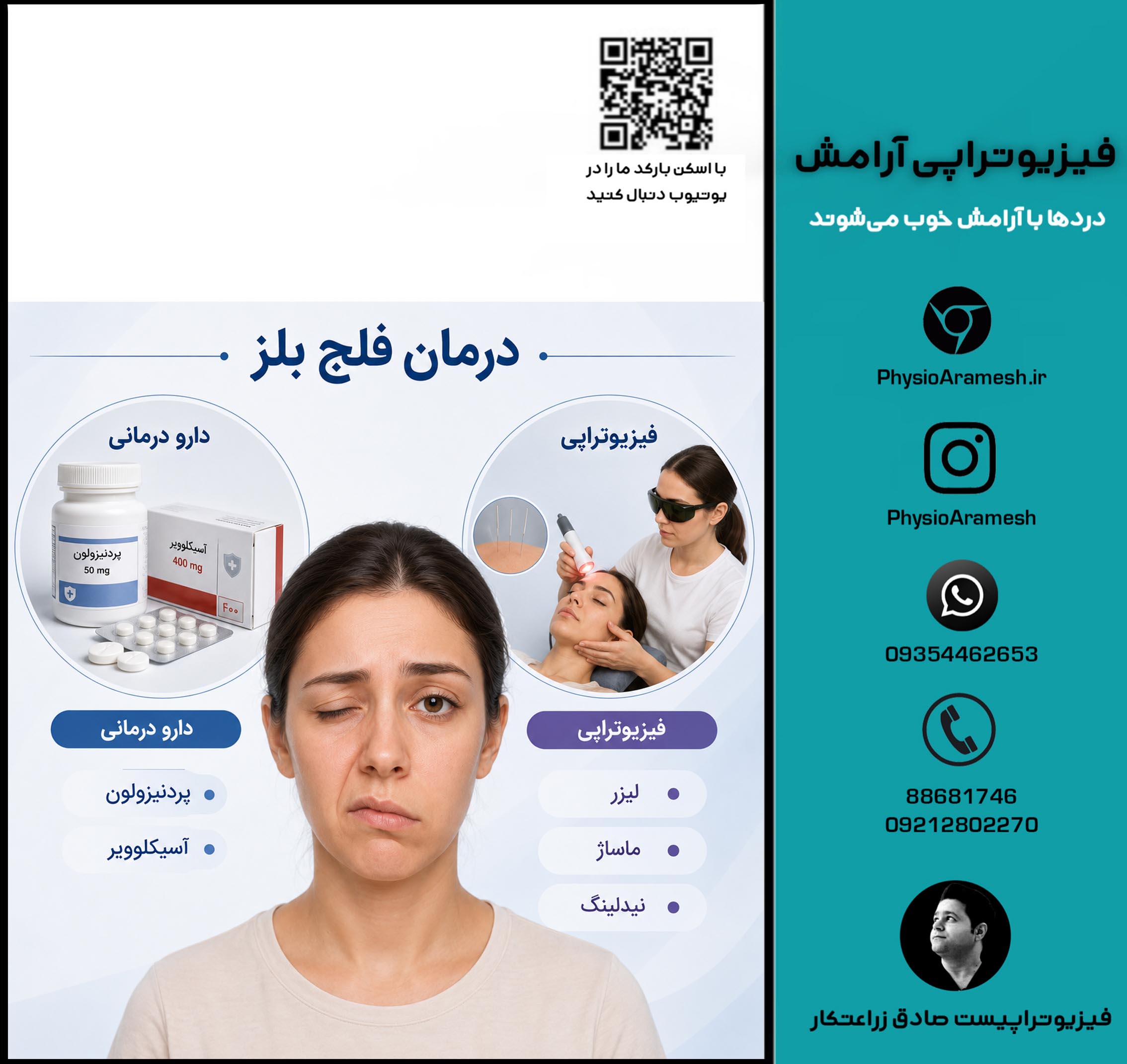 درمان فلج بلز
